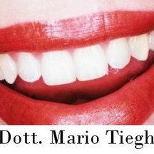 Dott. Mario Tieghi