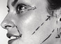 Face Surgery Messina