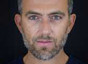 Dott. Valerio Ramieri