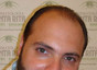 Dott. Antonio Del Sorbo