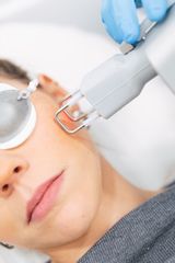 Láser CO2 - Clínica Soft