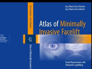 El Doctor Serra Mestre es autor del libro ‘Atlas of Minimally Invasive Facelift’