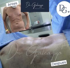 DR GALEAZZO