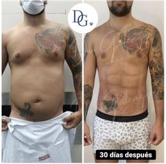 Damian Galeazzo