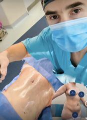 Abdominoplastia - Dr. Damián Galeazzo y Equipo