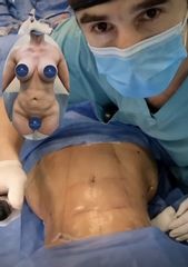 Liposucción - Dr. Damián Galeazzo y Equipo