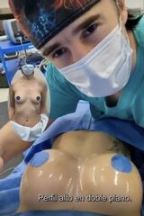 Aumento mamas - Dr. Damián Galeazzo y Equipo