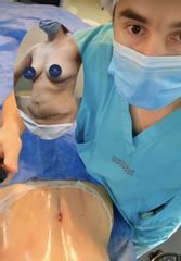 Abdominoplastia - Dr. Damián Galeazzo y Equipo