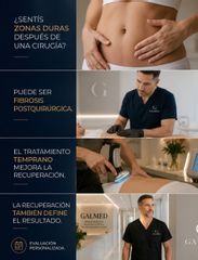 Fibrosis postquirúrgica: qué es, por qué aparece y cómo puede tratarse -  Galeazzo Cirugia & Estetic
