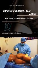 HISTORIA DR LIPO 360