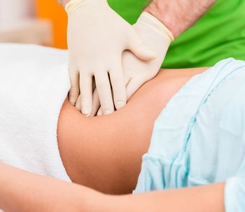 L'addominoplastica corregge la diastasi addominale