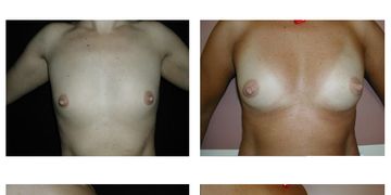 L'avvento della chirurgia estetica rigenerativa L'avvento della chirurgia estetica rigenerativa