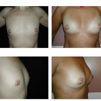 L'avvento della chirurgia estetica rigenerativa