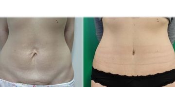 La differenza che si nasconde dietro un preventivo La differenza che si nasconde dietro un preventivo