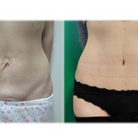 La differenza che si nasconde dietro un preventivo La differenza che si nasconde dietro un preventivo