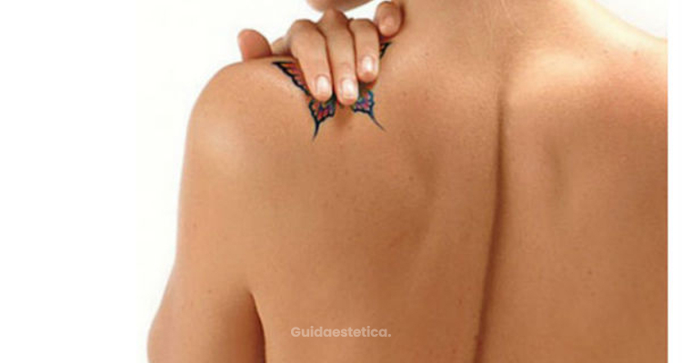 PicoSure, l’ultima frontiera nell’eliminazione dei tatuaggi