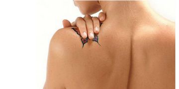 PicoSure, l’ultima frontiera nell’eliminazione dei tatuaggi