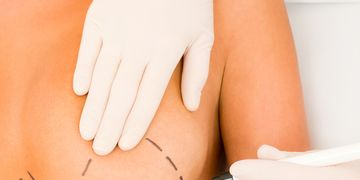 Seno rifatto o seno naturale, come fare per non sbagliare?