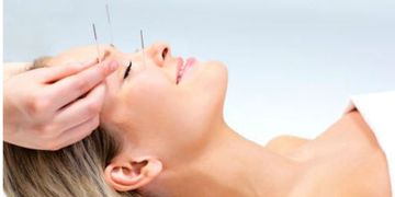 Agopuntura: il “bio-lifting” che ringiovanisce il viso