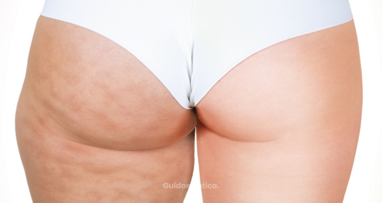 La liposuzione è pericolosa?