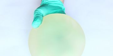 La mastoplastica additiva: il posizionamento delle protesi mammarie
