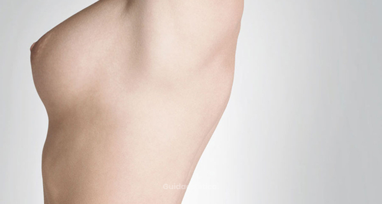 Mastoplastica additiva: 8 cose da sapere