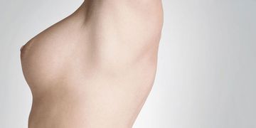 Mastoplastica additiva: 8 cose da sapere Mastoplastica additiva: 8 cose da sapere