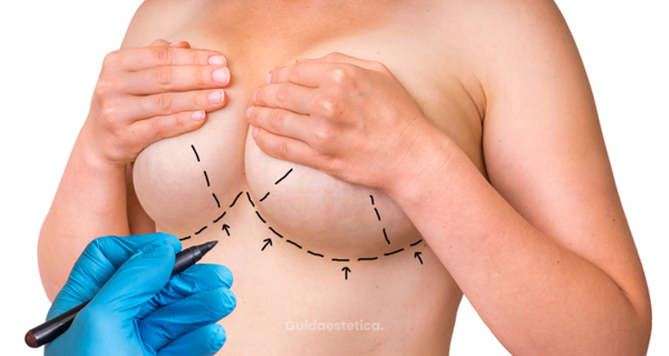 Chirurgia estetica del seno: una scelta consapevole