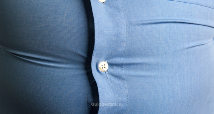 Riduzione dello stomaco: Sleeve Gastrectomy e POSE