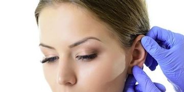 EAR FOLD soluzione innovativa per la correzione delle orecchie a sventola