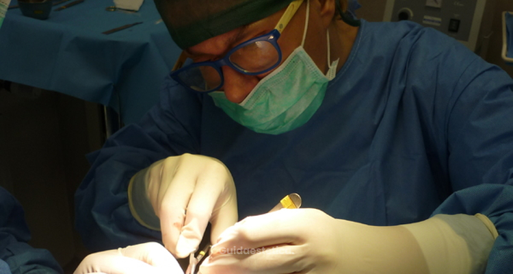 Via i cuscinetti di grasso con la liposcultura e il fisico torna tonico e asciutto