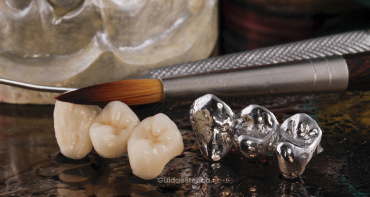 Quali materiali si usano per l'otturazione dei denti?