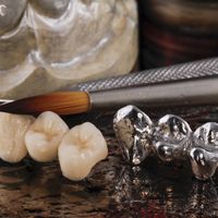 Quali materiali si usano per l'otturazione dei denti?