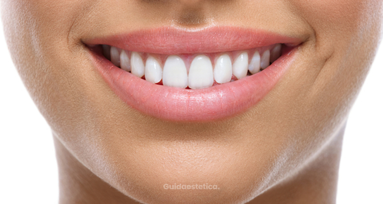 Sbiancamento dentale: le cose da sapere