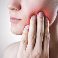 La malattia parodontale
