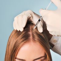 Alopecia: perché si produce e come curarla