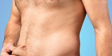 Cellulite maschile: come eliminarla?
