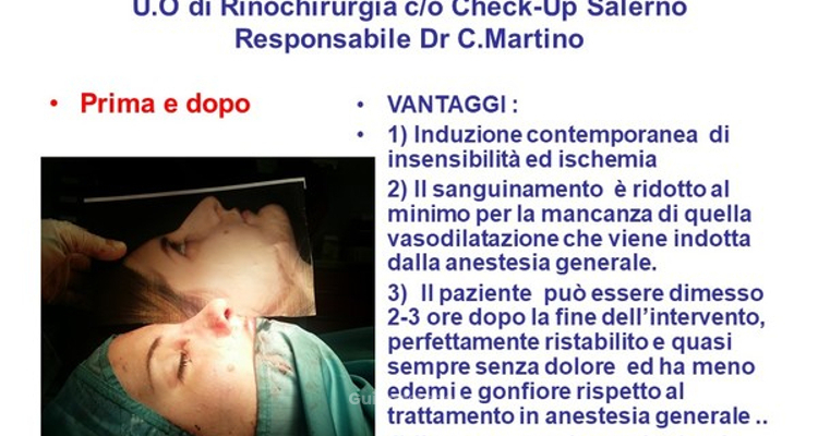 Rinoplastica: tecnica ibrida in anestesia locale