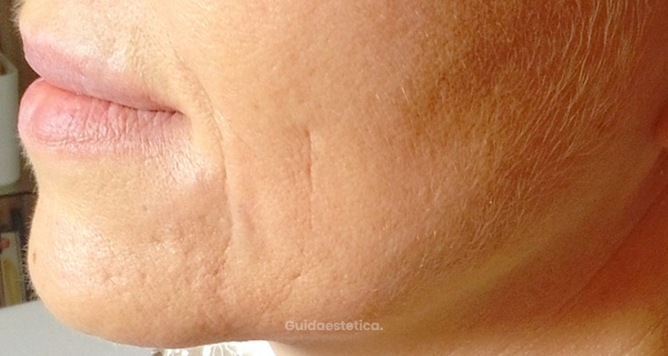 Cos'è l'ingegneria estetica?