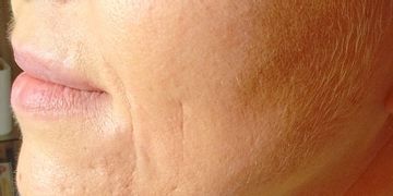 Cos'è l'ingegneria estetica?
