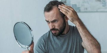Terapie mediche e chirurgiche per l’alopecia androgenetica maschile