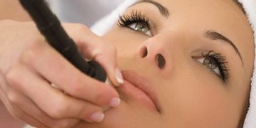 I 6 benefici del trattamento Laser Skin Resurfacing