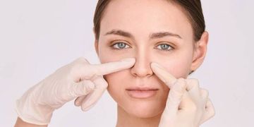 La Rinoplastica: migliora il profilo e l’aspetto del naso