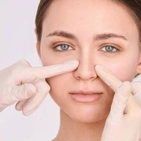La Rinoplastica: migliora il profilo e l’aspetto del naso