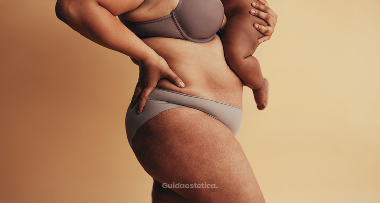 Tornare in forma dopo la gravidanza con il Mommy Makeover