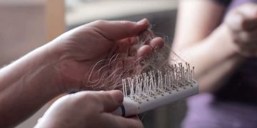 Alopecia Femminile - Perdita di capelli Cura e Prevenzione