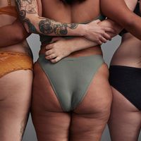 La cellulite, una condizione estetica comune e spesso frustrante