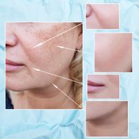 Come eliminare le rughe del viso: soluzioni efficaci e non invasive