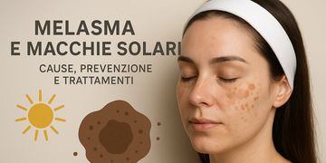 Melasma e macchie solari: cause, prevenzione e trattamenti professionali per eliminarle