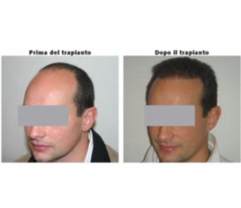 quali-innovazioni-in-chirurgia-estetica-chiediamolo-al-dott-caboni-2-ai2.jpg